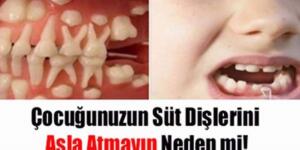 Çocuğunuzun süt dişlerini sakın atmayın! Bakın neye yarıyor