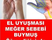 Meğer Elinizin Uyuşma Sebebi Buymuş