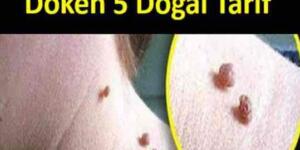 Et Benleri için 5 Doğal Tarifler! Patır Patır Dökülecekler