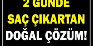 Saç Dökülmesini Durdurmak ve Saçınızı Gürleştirmek İçin Doğal Tarifler