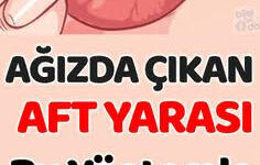 Aft Yarası Neden Çıkar, Kaç Günde Nasıl Geçer?
