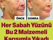 Her Sabah Yüzünü Bu 2 Malzemeli Karışımla Yıkadı Sonuç Gerçekten Mükemmel