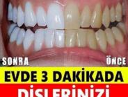 Evde 3 dakikada dişlerinizi beyazlatmak mümkün