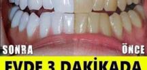 Evde 3 dakikada dişlerinizi beyazlatmak mümkün