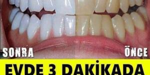 Evde 3 dakikada dişlerinizi beyazlatmak mümkün