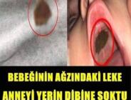 Bebeğinin ağzındaki leke için doktora götürdü, gerçeği öğrenince şaşkına döndü