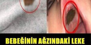 Bebeğinin ağzındaki leke için doktora götürdü, gerçeği öğrenince şaşkına döndü