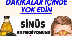 Bu Karışımla Migren-Sinüs Enfeksiyonunu Dakikalar İçinde Yok Oluyor