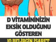 D Vitamini Eksikliği Belirtileri