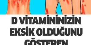 D Vitamini Eksikliği Belirtileri