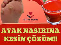 Ayak Nasırına Kesin Çözüm !!! Okumak için mavi yazıya tıklayın
