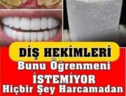 Diş Hekimleri Bunu Öğrenmeni İstemiyor! Diş Hekimine Gitmeden 3 Dakikada Tartarı Ortadan Kaldırın!