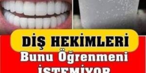 Diş Hekimleri Bunu Öğrenmeni İstemiyor! Diş Hekimine Gitmeden 3 Dakikada Tartarı Ortadan Kaldırın!