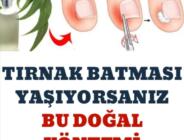 Tırnak batması yaşıyorsanız bu doğal yöntemi denemelisiniz!