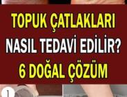 Topuk Çatlakları Nasıl Giderilir? Çok Etkili Doğal Yöntemler