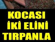 20 yaşındayken kocası ellerini kesti, acısı hala dinmedi