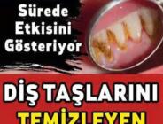 Diş taşlarından kurtulmak için bu yöntemi deneyin! İşte dişleri temizleyen süper yöntem…