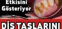 Diş taşlarından kurtulmak için bu yöntemi deneyin! İşte dişleri temizleyen süper yöntem…