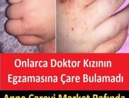 Onlarca Doktor Kızının Egzamasına Çare Bulamadı, Anne Çareyi Market Rafında Şans Eseri Buldu