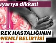 BÖBREK HASTALIĞININ 10 BELİRTİSİ