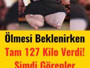 Ölmesi beklenen genç kadın 127 kilo verdi