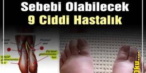 ŞİŞEN AYAKLARINIZI HAFİFE ALMAYIN. İŞTE AYAK ŞİŞLİKLERİNİN SEBEBİ OLABİLECEK 9 CİDDİ HASTALIK