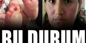 Küçük Çocuklarının Ayağının Altı Su Topladı, Aile Gerçeği Öğrendiğinde Şoke Oldu