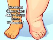 Vücuttaki Ödem Nasıl Atılır? Ödem Atma Yöntemleri