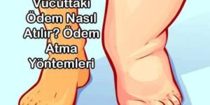 Vücuttaki Ödem Nasıl Atılır? Ödem Atma Yöntemleri
