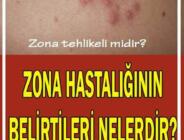 Zona hastalığı nedir? Belirtileri ve tedavi yöntemleri nelerdir?