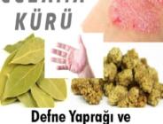 Egzamaya ve İltihaba Karşı Dutu Kaynatıp Sabah Aç Karnına İçin – Prof.Dr. İbrahim Saraçoğlu