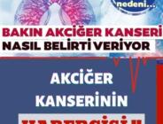 Akciğer kanseri belirtileri nelerdir? Akciğer kanserinden ne zaman şüphe edilmeli?