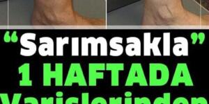 Sarımsakla Varisli Damarlardan Kurtulma