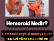 Hemoroid Neden Olur ve Tedavisi
