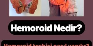 Hemoroid Neden Olur ve Tedavisi