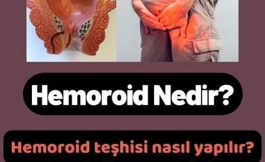 Hemoroid Neden Olur ve Tedavisi