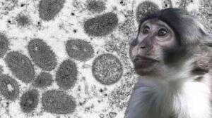 Maymun Çiçeği Hastalığı konusunda KAMUOYU MÜSTERİH OLMALI: Hayvan kaynaklı olan, bazen insanlara da bulaşan bu hastalık bir Pandemiye yol açmaz. Semptomların genellikle 2-3 hafta içinde kendiliğinden düzeldiği bilinmektedir. Afrika'da görülen hastalığa ülkemizde rastlanmamıştır.