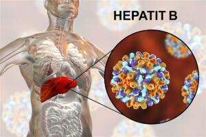 Karaciğer iltihabı anlamına gelen ve Türkiye’de yaklaşık 3 milyon kişide görülen Hepatit B hastalığıyla ilgili genel bilgiler ve tedavi yöntemleri aşağıda verilmiştir.