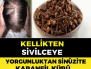 KELLİKTEN, SİVİLCEYE YORGUNLUKTAN SİNÜZİTE MÜKEMMEL KÜR