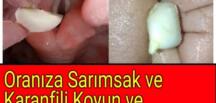 Her Gün orasına Sarımsak Koyan kadın Bakın Nasıl Bir Mucizeyle Karşılaştı