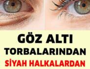 Göz Altı Torbaları ve Morlukları İçin Evde Uygulayabileceğiniz 8 Doğal Çözüm