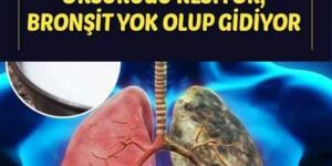 Tepeden tırnağa yeniliyor! Her derde deva sarımsaklı süt kürü