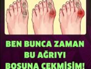 Ayak Baş Parmağının Yanında Oluşan Kemi̇k Çıkıntısı (bünyon) Nasıl Geçer?