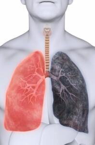 Akciğer Detoksu Nasıl Yapılır?