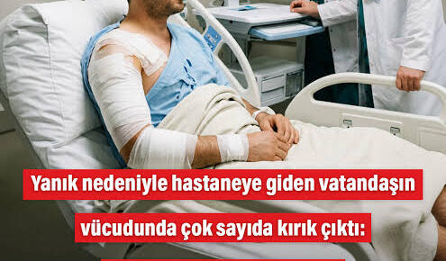 Sosyal medyada viral olan o kara mizah tadındaki trajikomik Kaza